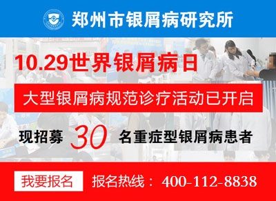 倒计时！世界银屑病日大型会诊活动 仅限10.29